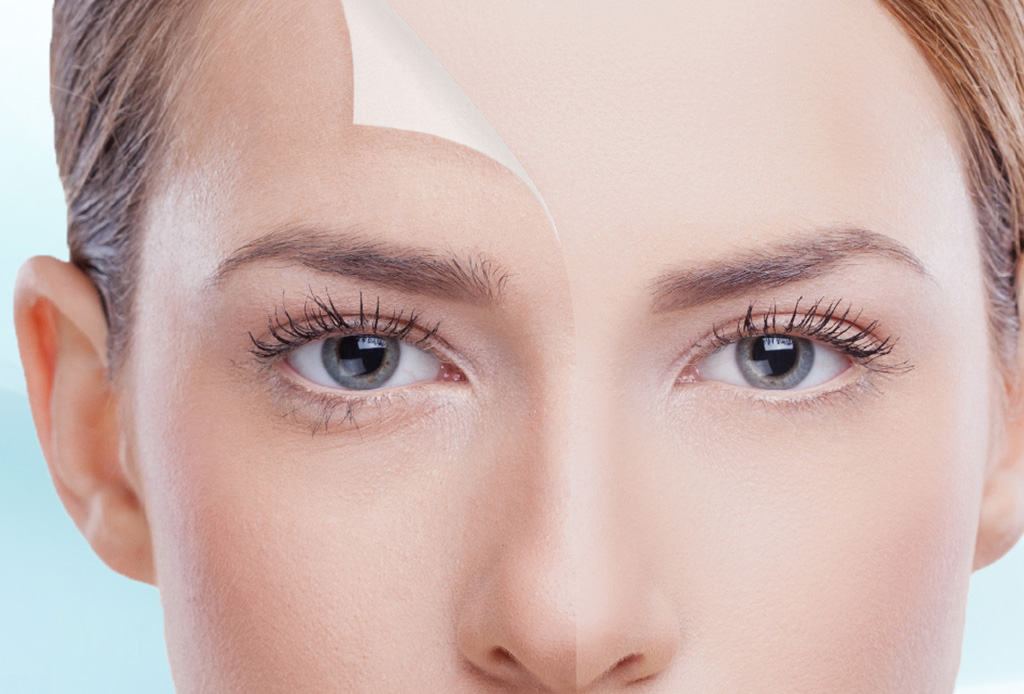 Esto es lo que le pasa a tu piel cuando te haces exfoliaciones químicas - exfoliacion7